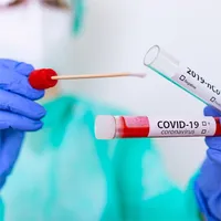 [A00129276] - SCREEN TEST COVID-FLU A/B Test rapido immunocromatografico individuazione qualitativa antigeni virus SARS-CoV-2 + Influenza A e B presenti in campioni da tampone rinofaringeo Screen Italia – Image 1