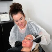 MICRONEEDLING – Image 1