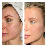 LumiSpa iO + Cleanser – Image 4