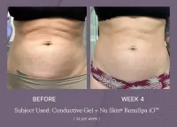 ageLOC WellSpa iO – Image 5