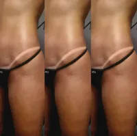 3 versa Sessions ad on $149.. – Image 1