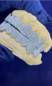 Custom Diamond Grills – Image 1