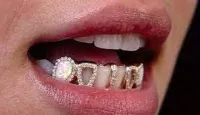 10KT-22KT Opal Grills with Gap Filler – Image 1