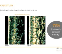 Skinade Daily Collagen Supplement – Image 5