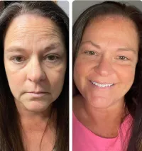 LumiSpa iO + Cleanser – Image 5