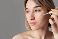Acneviar Facial – Image 1