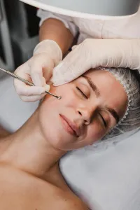 Acneviar Facial – Image 3