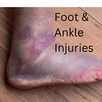 Common Foot And Ankle Injuries – Image 1