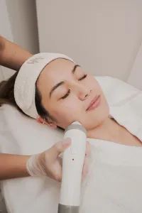 RF Skin Tightening – Image 1