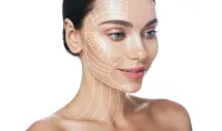 Facial Package 12 treatments – Image 1