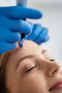 Eye Lift Device – Image 3