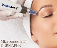 Microneedling + Exasome + LED Therapy – Image 1