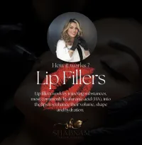 Lip Filler – Image 4