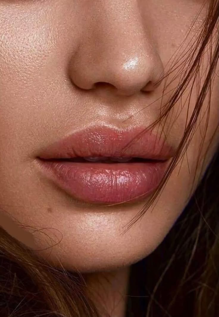 Lip Filler – Image 3