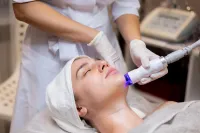 Cryo Face Lift  – Image 1