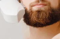 6 Sessions Beardline + Full Neck Laser Hair Removal – Image 1