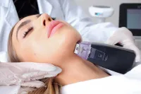 1 Jawline Sculpting session – Image 1