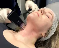 Jawline Sculpting Treatment – Image 2