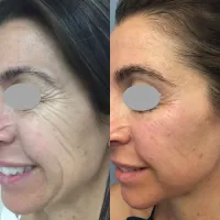 Forma Facial – Image 3