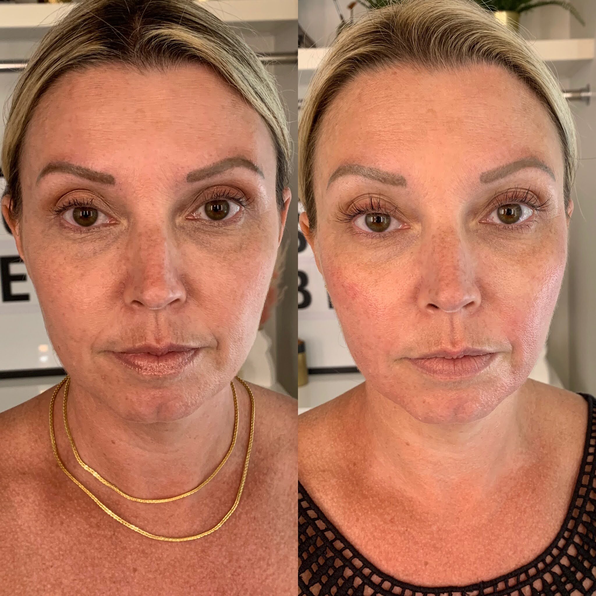 Forma Facial – Image 2