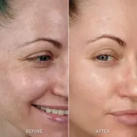 3 Korean V-Lift Sculpting Facial Package – Image 2