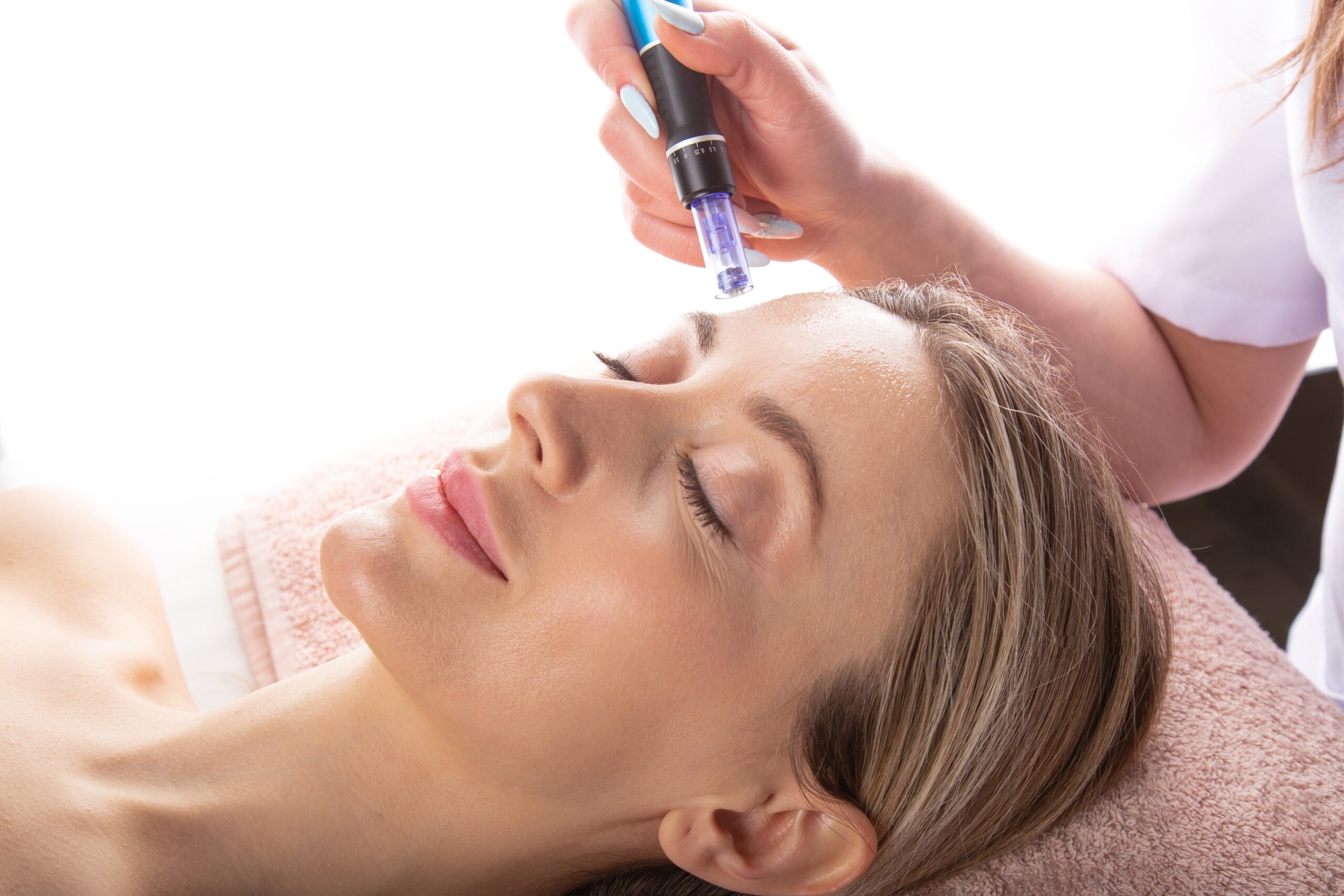 Microneedling Pen with Exosome Booster – Face – Image 1
