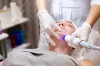 Ageless Microneedling – Image 1