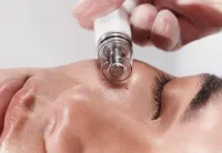 Deluxe HydroFacial – Image 3