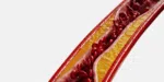 Red blood cells flowing