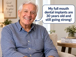 How Long Should Dental Implants Last?