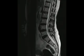 Why Normal Imaging Does Not Mean Nothing Is Wrong