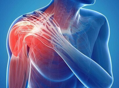 Understanding Your Shoulder Pain: Biceps Tendonitis vs. Shoulder Impingement