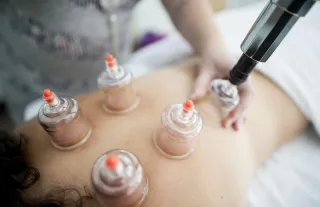 What Is Myofascial Cupping