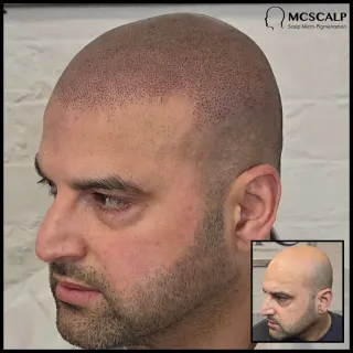 FAQ image