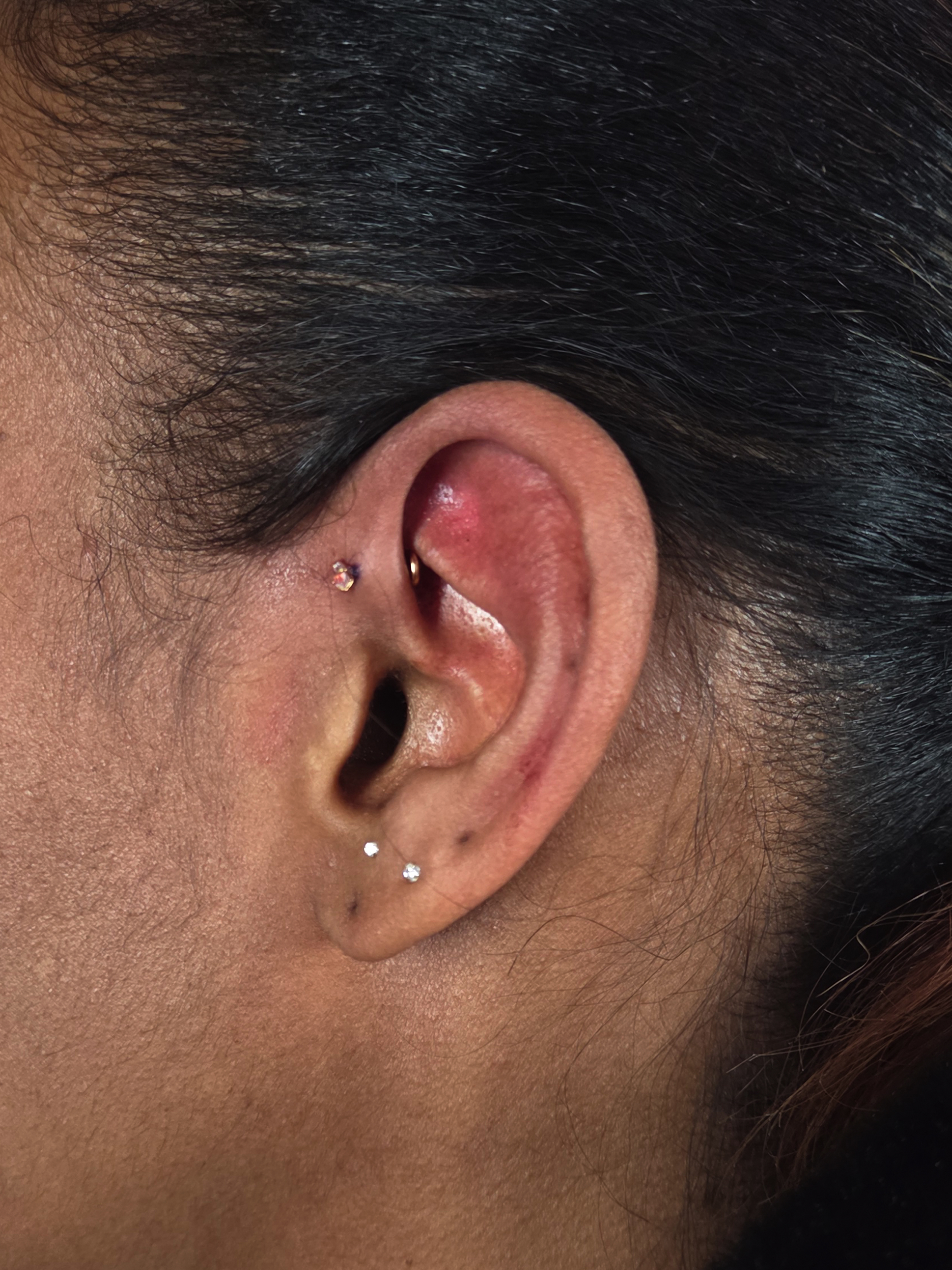 Forward Helix Piercing