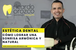 Estética dental: cómo lograr una sonrisa armónica y natural