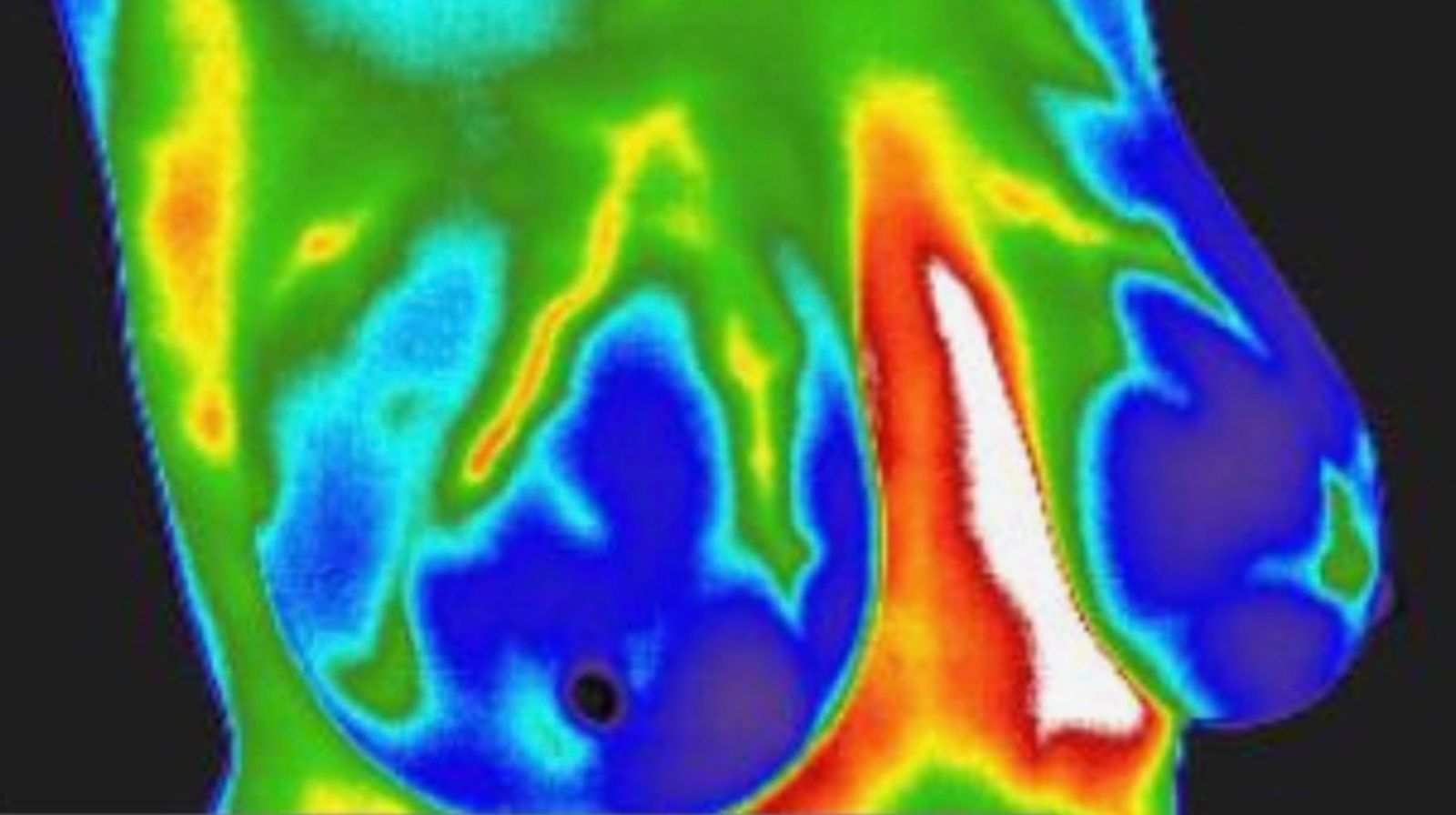 Thermography & Chronic Stress: Moving from Fight-or-Flight to Rest-and-Digest