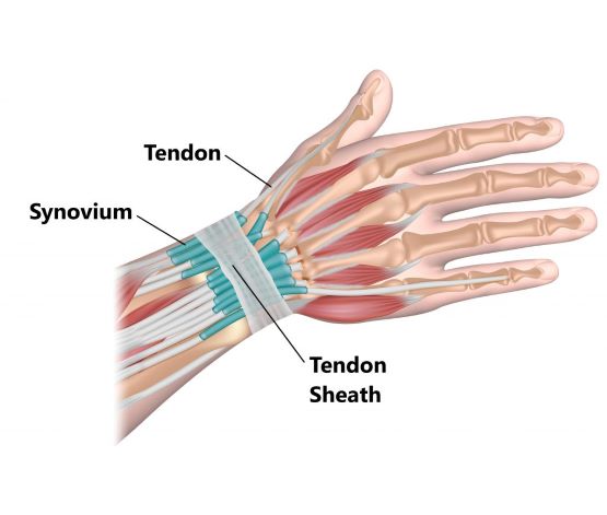 De Quervain’s Tenosynovitis