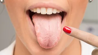 What Your Tongue Says About Your Health: An Ayurvedic Guide