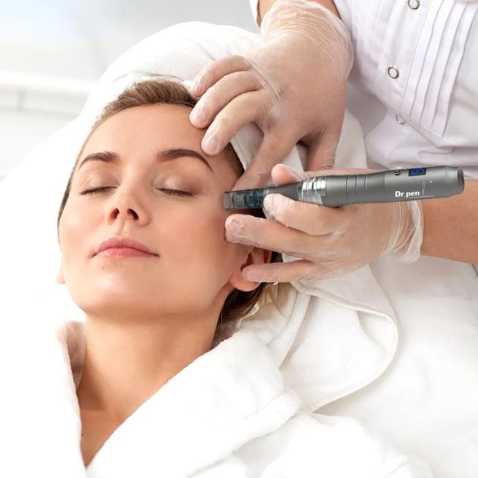 Microneedling in Calgary: Benefits, Recovery, Results, and What to Expect