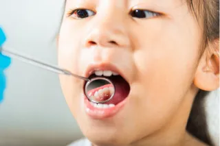Why Does My Child Keep Getting Cavities? Mouth Breathing, Hidden Causes & What to Do