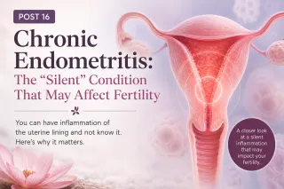 Chronic Endometritis: The “Silent” Condition That May Affect Fertility