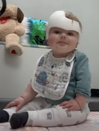 Plagiocephaly