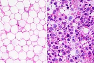 NON TUTTE LE STAMINALI SONO UGUALI: CONFRONTO TRA TESSUTO ADIPOSO E MIDOLLO OSSEO