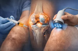  ULTRASUONI TERAPEUTICI NELL’ARTROSI: STIMOLAZIONE BIOLOGICA E RECUPERO FUNZIONALE