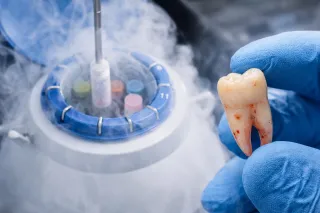 DAL DENTE DEL GIUDIZIO ALLA BANCA BIOLOGICA: LA NUOVA FRONTIERA DELLA MEDICINA