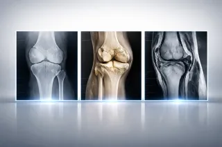 RX, TAC O RISONANZA? COME SCEGLIERE L'INDAGINE GIUSTA