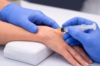 L'INFILTRAZIONE DELLA MANO E' TECNICA. IL RISULTATO E' BIOLOGICO