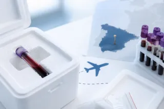 PERCHE’ L’ALLERGIA AI METALLI È COSÌ DIFFICILE DA DIAGNOSTICARE?