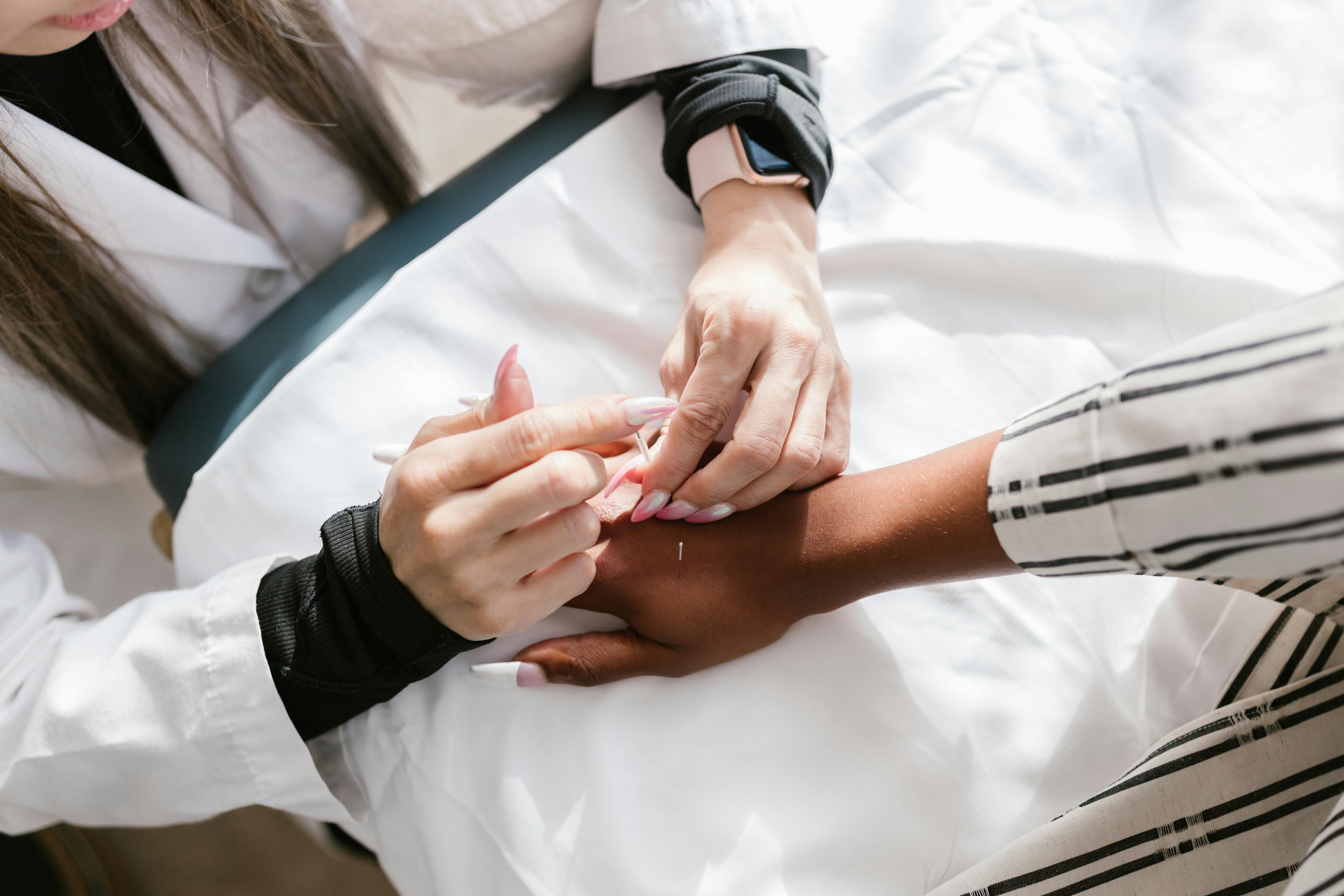 Is Acupuncture Worth It in Southlake TX?